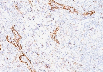 VEGFA Antibody / Vascular Endothelial Growth Factor A
