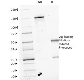 VEGFA Antibody / Vascular Endothelial Growth Factor A