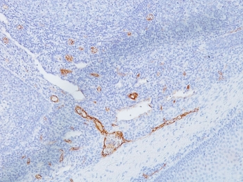 vWF Antibody