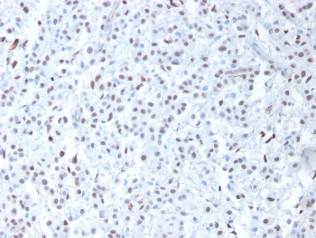 WT1 Antibody / Wilms Tumor 1