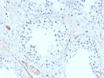 WT1 Antibody / Wilms Tumor 1