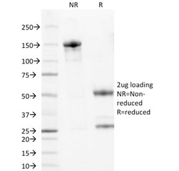 WT1 Antibody / Wilms Tumor 1