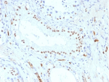 WT1 Antibody / Wilms Tumor 1