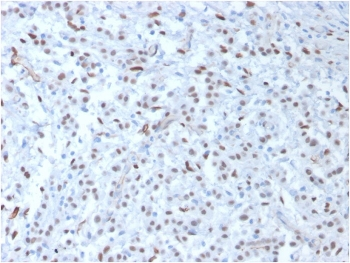 WT1 Antibody / Wilms Tumor 1