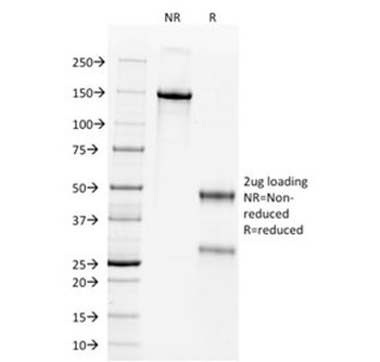 WT1 Antibody / Wilms Tumor 1