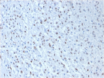WT1 Antibody Cocktail