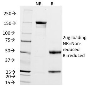 ZAP70 Antibody