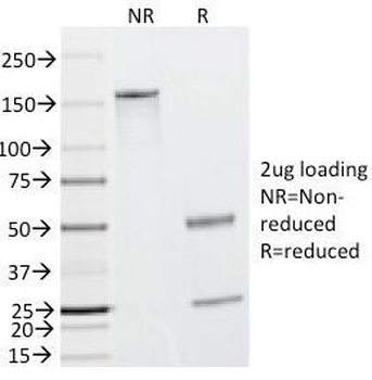 Caldesmon / CAD Antibody HMW