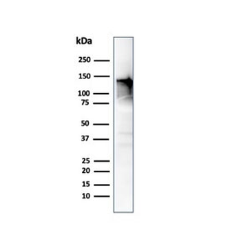 Caldesmon / CAD Antibody HMW
