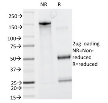 Caldesmon / CAD Antibody HMW