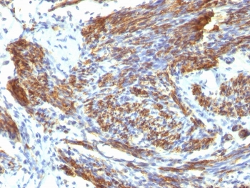 Caldesmon / CAD Antibody HMW