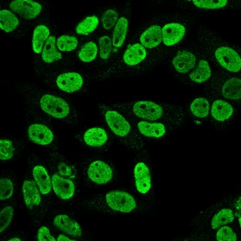 CCNB1 Antibody / Cyclin B1