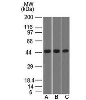 Napsin A Antibody Cocktail