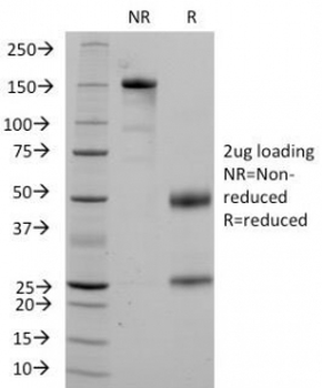 CD36 Antibody