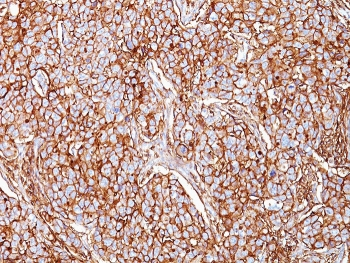 CD44 Antibody