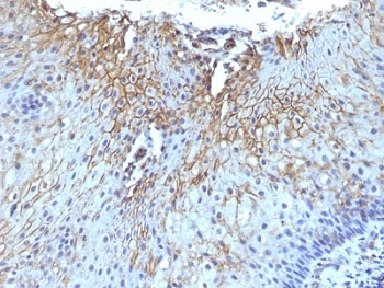 CD59 Antibody