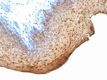 Cytokeratin 10/13 Antibody