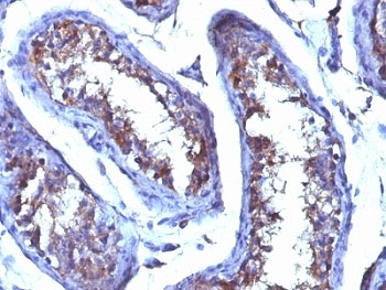Testosterone Antibody