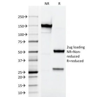 Testosterone Antibody