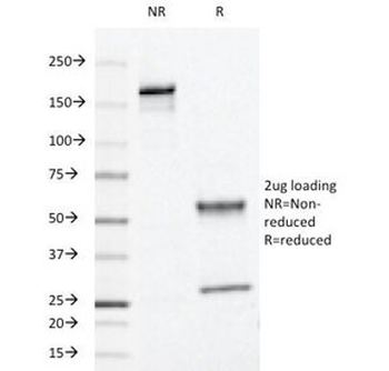HPV-16 L1 Antibody