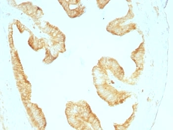 Multi Cytokeratin Antibody