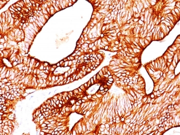 Cytokeratin 8/18 Antibody Cocktail