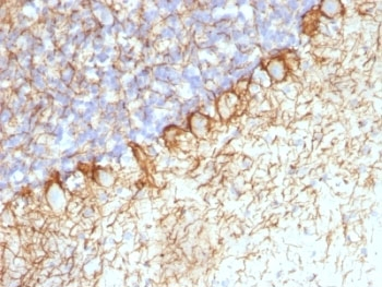Neurofilament Antibody Cocktail (Heavy + Light)