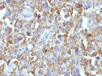 Macrophage / Histiocytoma Marker Antibody
