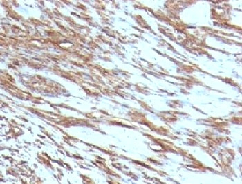 Actin Antibody (pan muscle)
