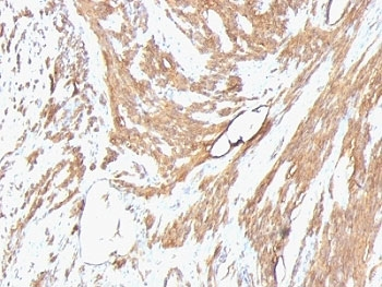 Actin Antibody Cocktail (pan muscle)