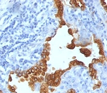 Cytokeratin 8/18 Antibody