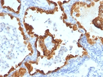 Cytokeratin 8/18 Antibody Cocktail