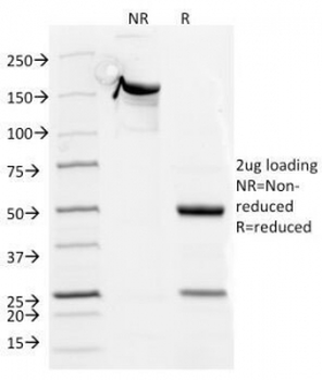 CD5 Antibody