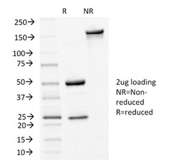 E-Cadherin Antibody / CDH1