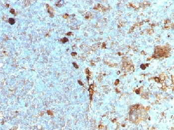 Alpha 1 Antitrypsin Antibody (Hepatocyte Marker)