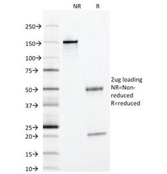 Alpha 1 Antitrypsin Antibody (Hepatocyte Marker)