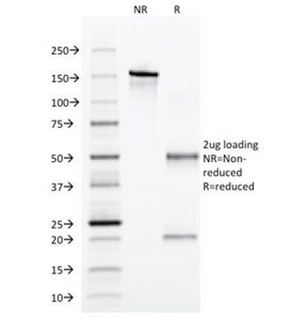 Alpha 1 Antitrypsin Antibody / AAT / SERPINA1