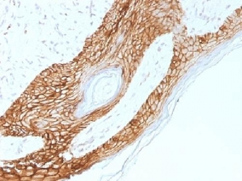 E-Cadherin Antibody / CDH1