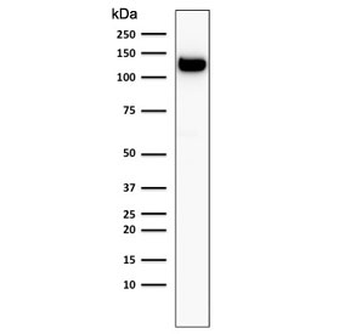 E-Cadherin Antibody / CDH1