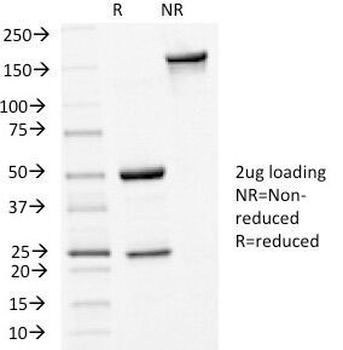 E-Cadherin Antibody / CDH1