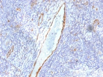 von Willebrand Factor Antibody