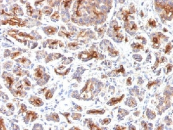 CFTR Antibody / Cystic Fibrosis Transmembrane Regulator