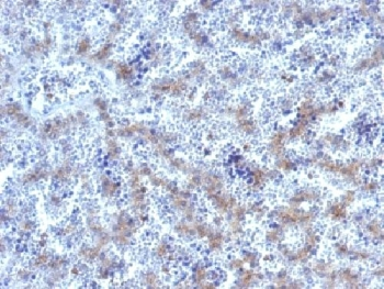 Glypican 3 Antibody / GPC3