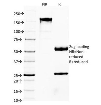FOXA1 Antibody