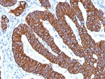 Cytokeratin 8/18 Antibody