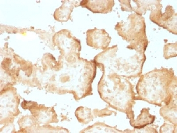 EGF Receptor / EGFR Antibody