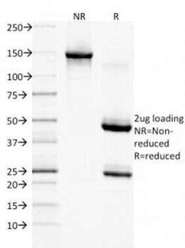 EGF Receptor / EGFR Antibody