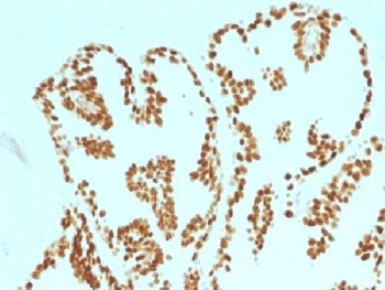 FOXA1 Antibody
