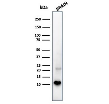 S100B Antibody