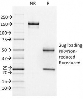FOXA1 Antibody